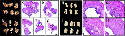 An Improved Dehydroepiandrosterone-Induced Rat Model of Polycystic Ovary Syndrome (PCOS): Post-pubertal Improve PCOS's Features